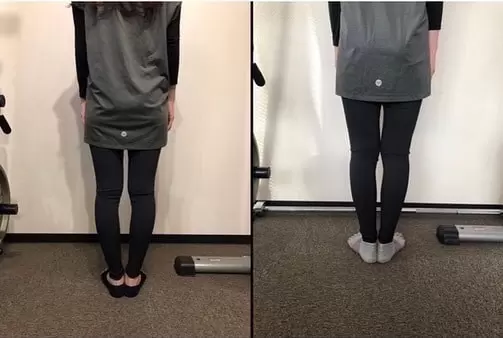 Before / After 01