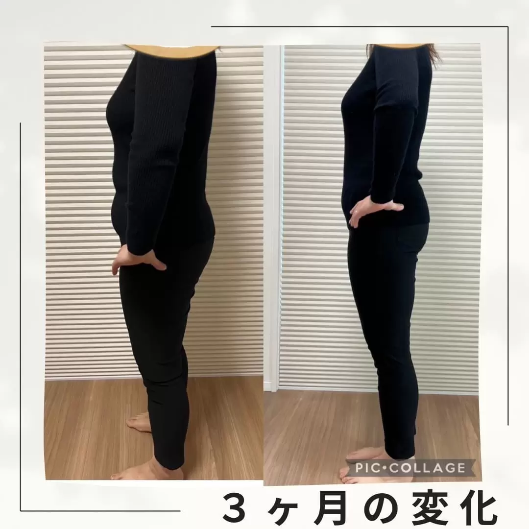 Before / After 03