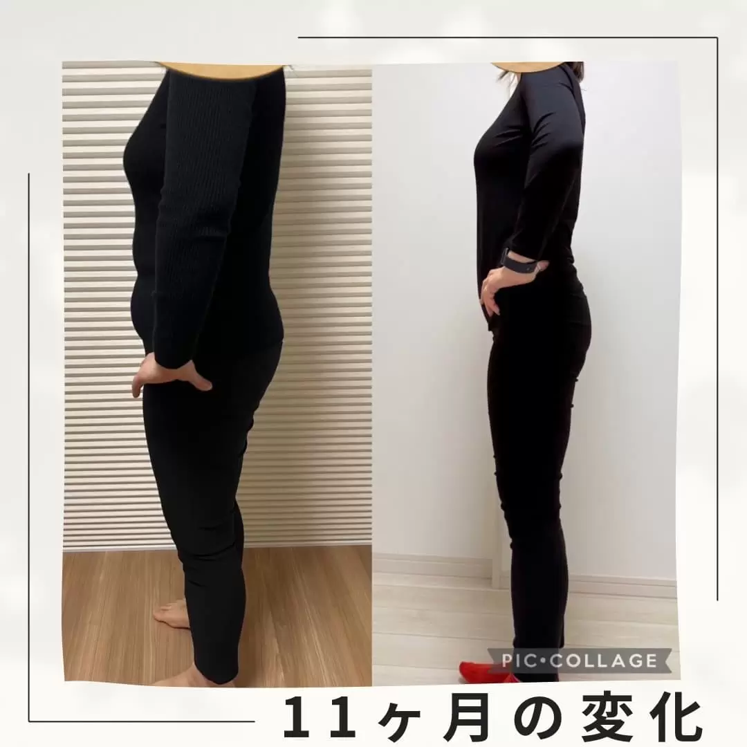 Before / After 05